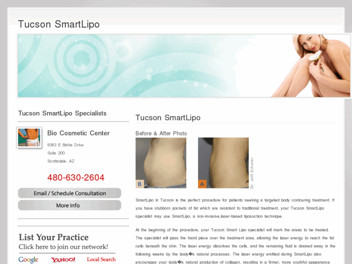 www.tucsonsmartlipo.com