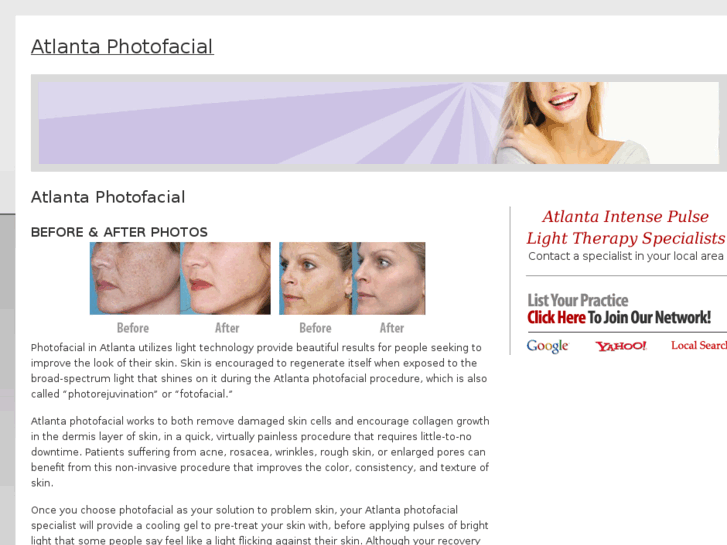 www.atlantaphotofacial.com
