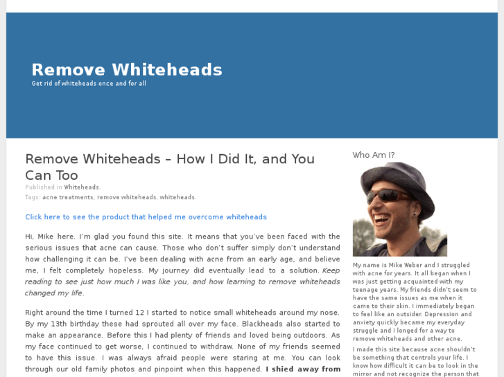 www.removewhiteheads.net