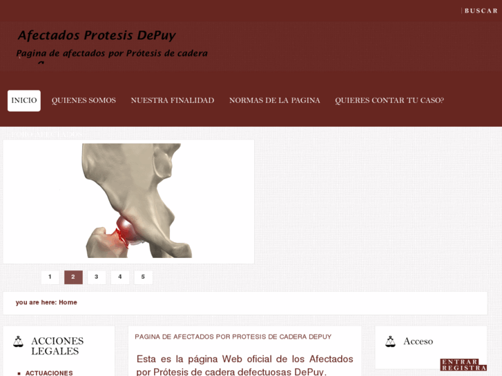 www.afectadosdepuy.com