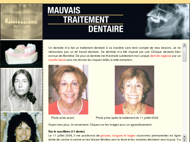www.mauvaistraitementdentaire.com