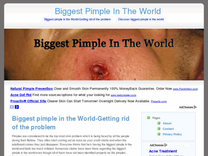 www.biggestpimpleintheworld.org