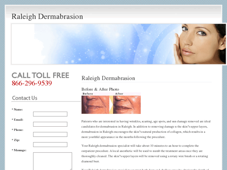www.raleighdermabrasion.com