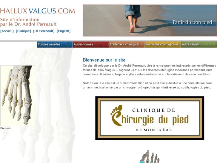 www.halluxvalgus.com