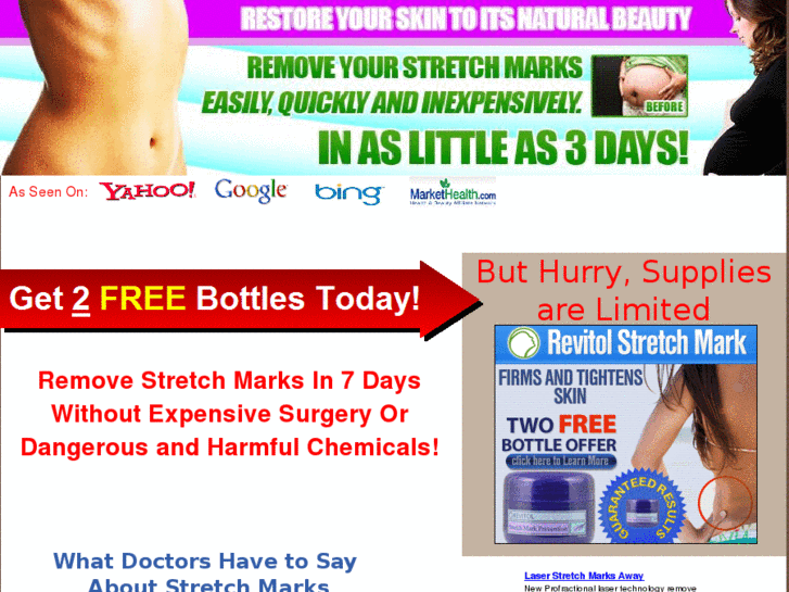 www.remove-stretchmarks.com