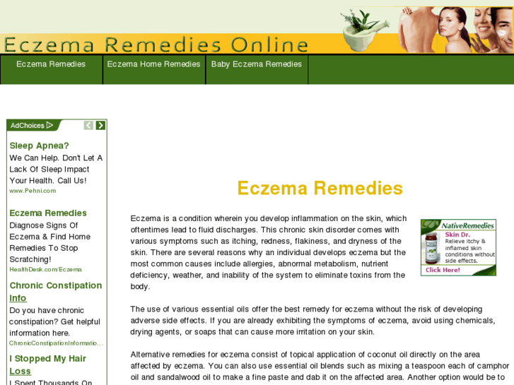 www.eczemaremediesonline.com