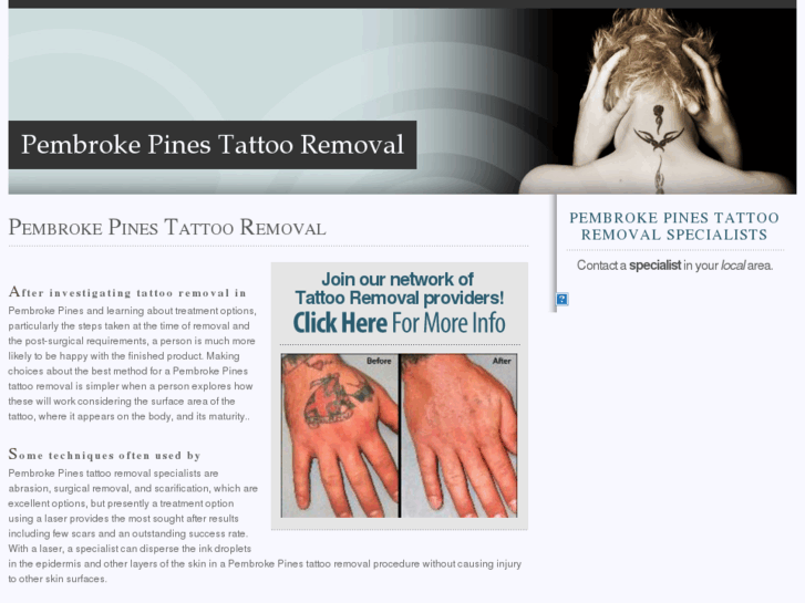 www.pembrokepinestattooremoval.com