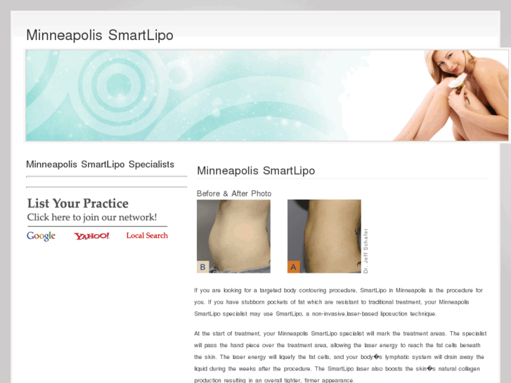 www.minneapolissmartlipo.com