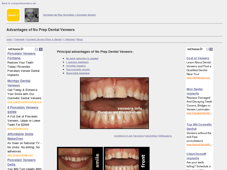 www.veneers.info