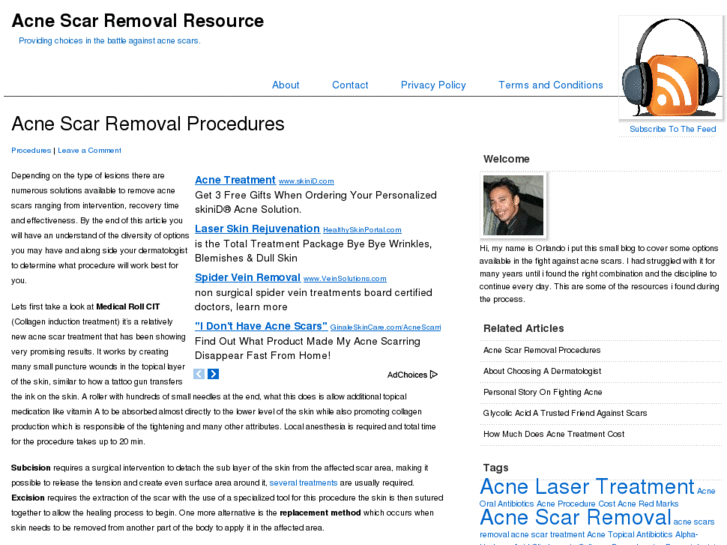 www.acnescarremovalresource.com