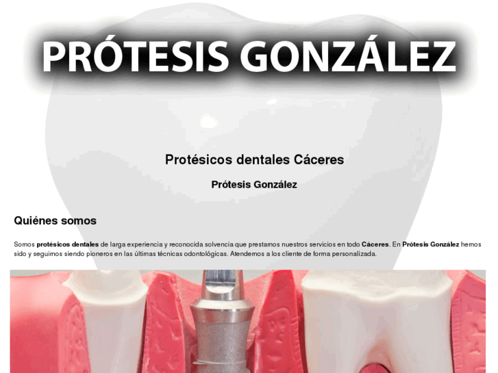 www.protesisgonzalez.com