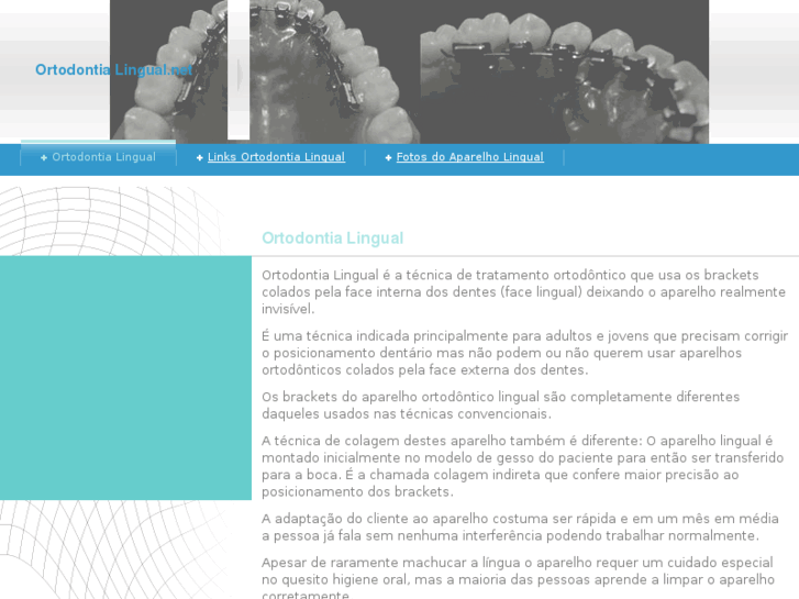 www.ortodontialingual.net
