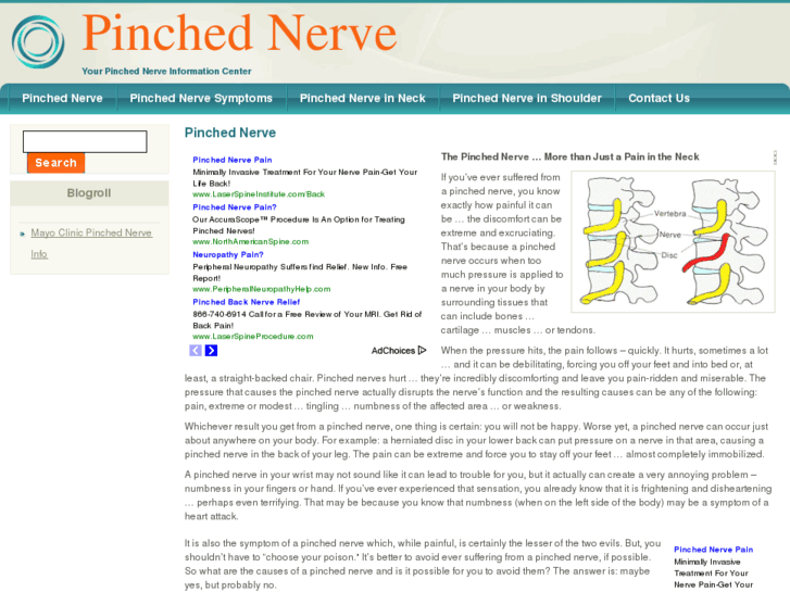 www.pinchednerve.org