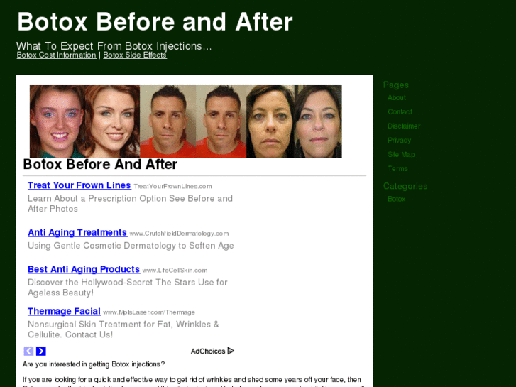 www.botoxbeforeandafter.org