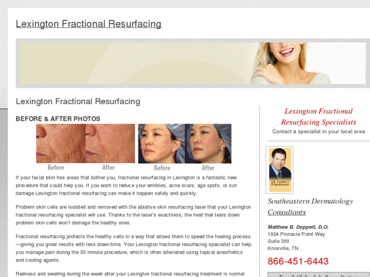 www.lexingtonfractionalresurfacing.com