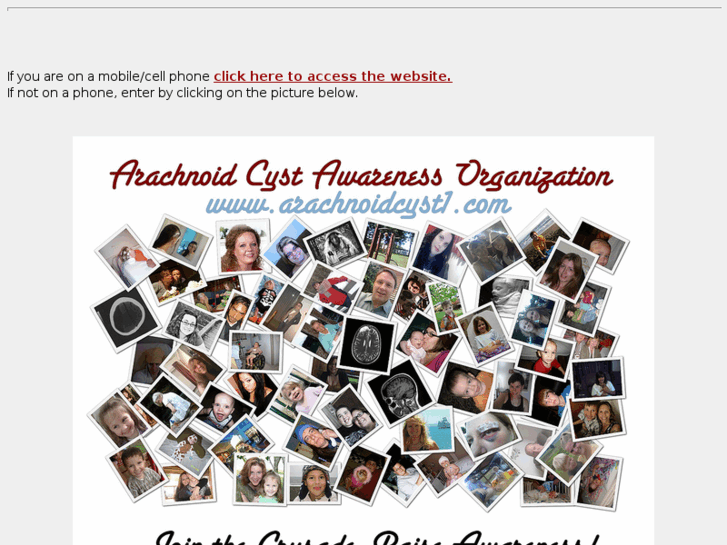 www.arachnoidcyst1.com