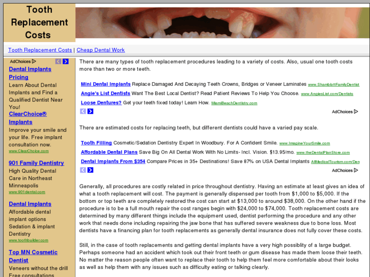 www.toothreplacementcost.com