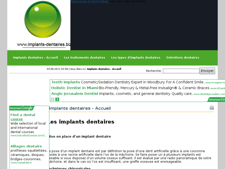 www.implants-dentaires.biz