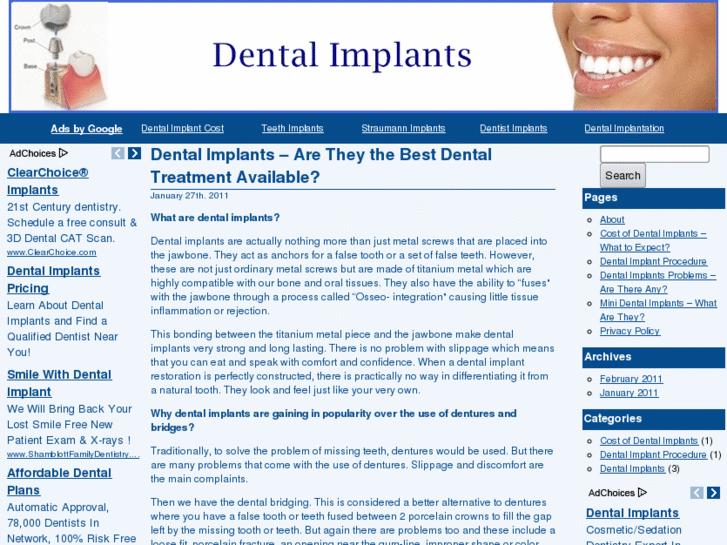 www.dentalimplantssearch.com