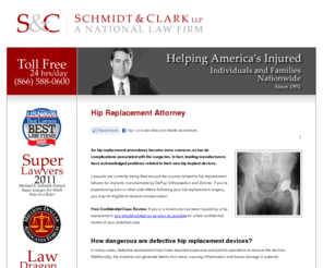 hipreplacementattorney.org: Hip Replacement Attorney
As hip replacement procedures become more common, so too do complications associated with the surgeries. If you’re experiencing pain or other side effects following your hip replacement surgery, you may be eligible to receive compensation.