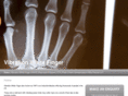 white-finger.com