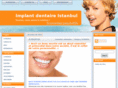 implantdentaireistanbul.com