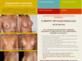 prothese-mammaire.ch