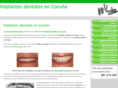 implantes-coruna.com