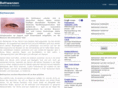 bettwanzen.net