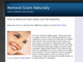 scarsaregone.com