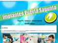 implantessagunto.com