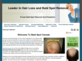 baldspot.ca