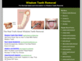 wisdom-teeth-removal.org