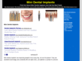 mini-dentalimplants.info