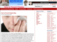 myacneerased.com