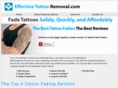 effectivetattooremoval.com