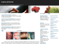 lupuspictures.org