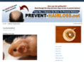 prevent-hairloss.net