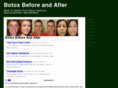 botoxbeforeandafter.org