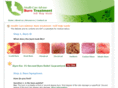 burnremedies.com
