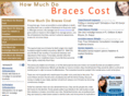 howmuchdobracescostnow.com
