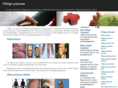 vitiligopictures.co.uk