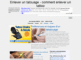 enlevertatouage.com