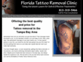 floridatattooremovalclinic.biz