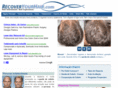 recuperarocabelo.com