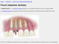 implante-dental.biz