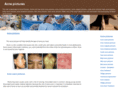 acne-pictures.org