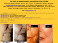 allo-peeling.com